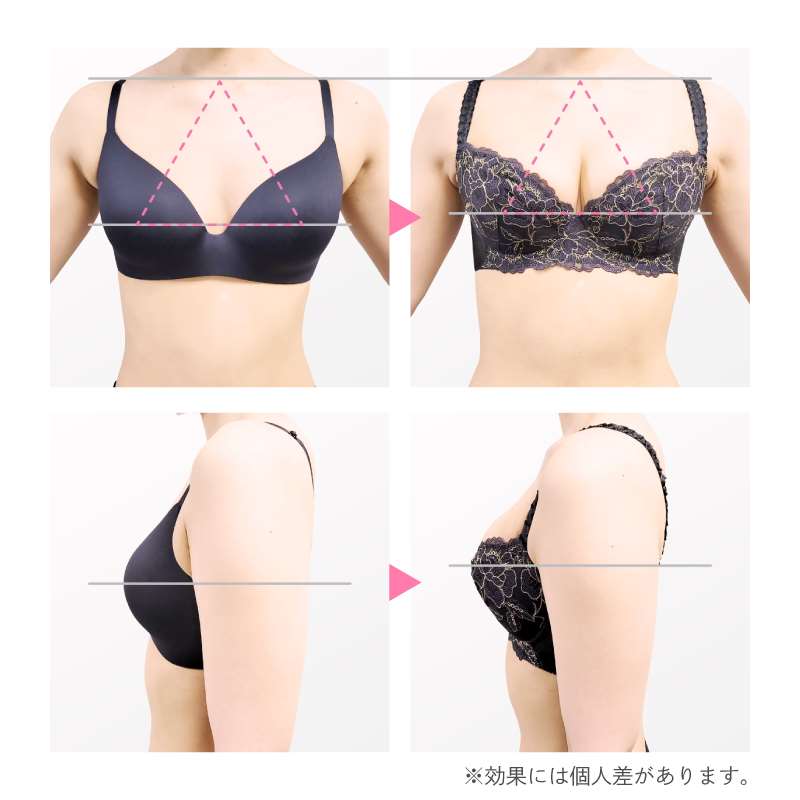 ベランジェブラ